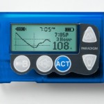 insulin_pump_medtronic